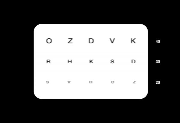 Vision with regular soft contact lens for a patient with astigmatism